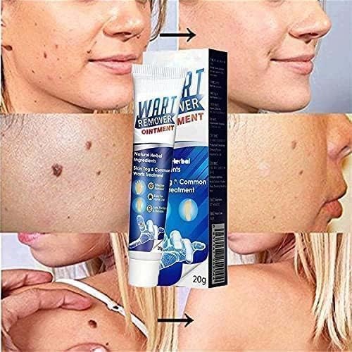 Advanced Wart Remover Cream – Fast-Acting Treatment for Warts, Moles & Skin Tags