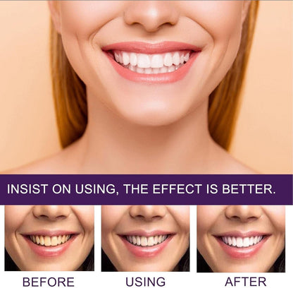 EELHOE Purple Tooth Whitening Corrector – Removes Yellow Stains & Brightens Teeth (50ml)