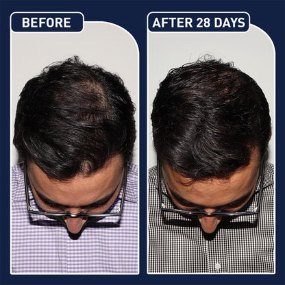 FEG Plus Hair Growth Stimulator Spray – Natural Formula with Anagain, Rosemary & Camellia (50ml)