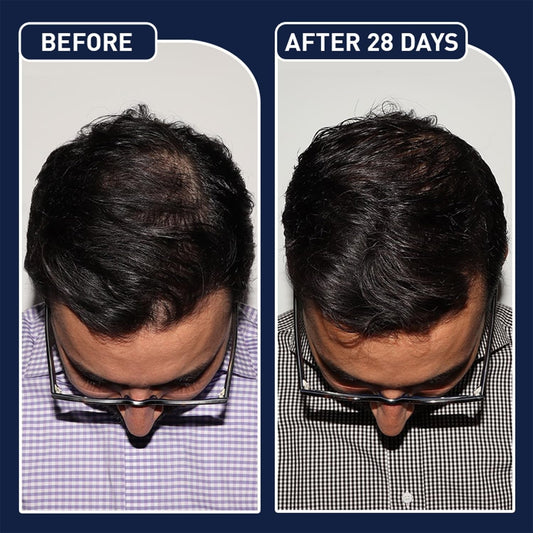 FEG Plus Hair Growth Stimulator Spray – Natural Formula with Anagain, Rosemary & Camellia (50ml)