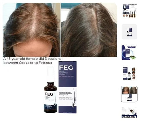 FEG Plus Hair Growth Stimulator Spray – Natural Formula with Anagain, Rosemary & Camellia (50ml)