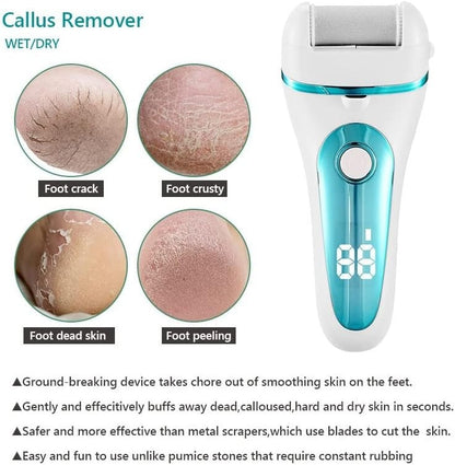 Electric Foot Callus Remover with LED Light – Smooth Feet in Minutes | High-Speed Motor